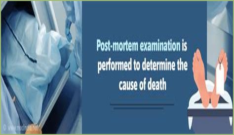 Autopsy 101: Demystifying the Post-Mortem Exam Process