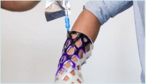 Autopsy Casts: New Tech Unveils Secrets Locked in Bone