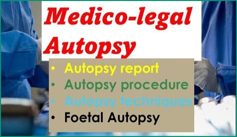 Autopsy Chaos: Is it 'Autospy' or 'Autopsy'? Common Misspellings Exposed!