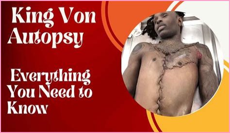 King Von Autopsy Photos: Leaked Images Spark Outrage!