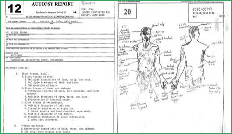 Kobe Autopsy Report: Shocking Details & Lingering Questions