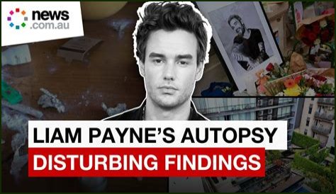 Liam Payne Autopsy Report: Shocking Leaks & Fan Theories Emerge